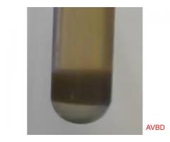 Lead Viruses Mercury Pesticides Fluoride Arsenic Taste/Odor 100% from Tap Water!
