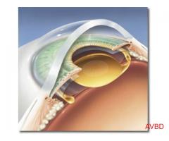 Beverly Hills Center For Vision Correction