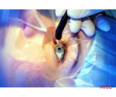 Beverly Hills Center For Vision Correction